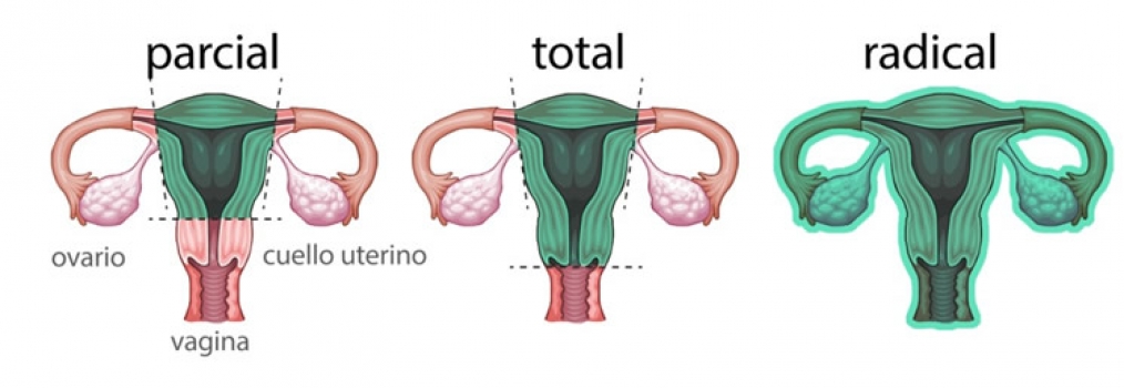 Trato genital feminino (colo uterino, ov�rio, �tero)